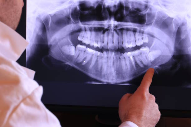 Best Broken or Chipped Tooth Repair in Englewood, NJ