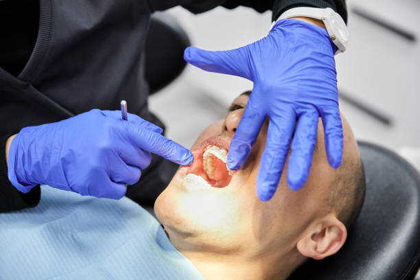 Best Emergency Dental Care for Sports Injuries in Englewood, NJ